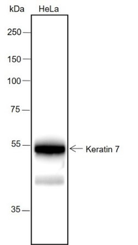 Keratin 7 Recombinant Rabbit Monoclonal Antibody
