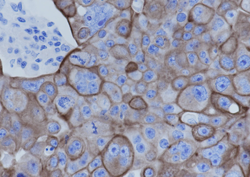 Keratin 7 Recombinant Rabbit Monoclonal Antibody