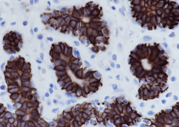 Keratin 7 Recombinant Rabbit Monoclonal Antibody