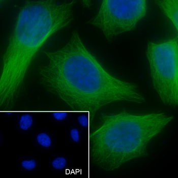 IDH1 Recombinant Mouse Monoclonal Antibody