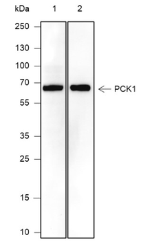 PCK1 Recombinant Mouse Monoclonal Antibody