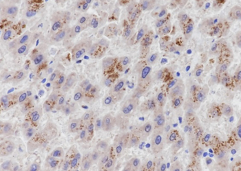 PCK1 Recombinant Mouse Monoclonal Antibody
