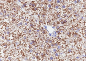 PCK1 Recombinant Mouse Monoclonal Antibody