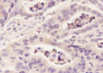 ALDOA Recombinant Rabbit Monoclonal Antibody