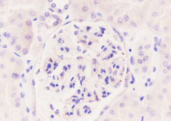 CGA Recombinant Rabbit Monoclonal Antibody