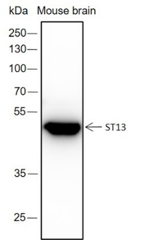 ST13 Recombinant Rabbit Monoclonal Antibody