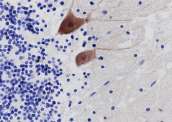 CALB1 Recombinant Mouse Monoclonal Antibody