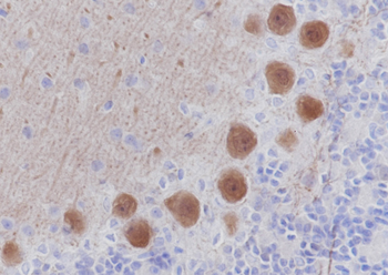 CALB1 Recombinant Mouse Monoclonal Antibody