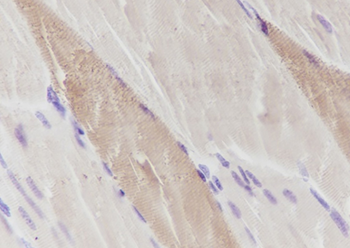 MYL3 Recombinant Mouse Monoclonal Antibody