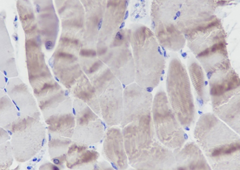 MYL3 Recombinant Mouse Monoclonal Antibody