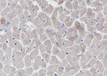 MYL3 Recombinant Mouse Monoclonal Antibody