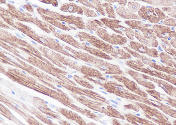 Myosin light chain 3 Recombinant Rabbit Monoclonal Antibody