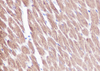 Myosin light chain 3 Recombinant Rabbit Monoclonal Antibody