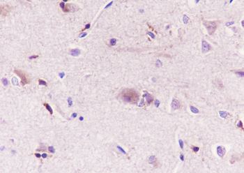 WWOX Recombinant Rabbit Monoclonal Antibody