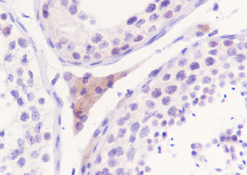 WWOX Recombinant Rabbit Monoclonal Antibody