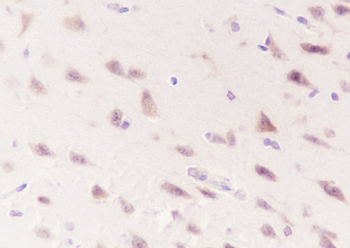 WWOX Recombinant Rabbit Monoclonal Antibody