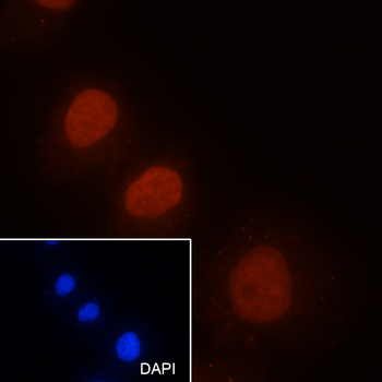 Di-Methyl-Histone H3 (Lys9) Mouse Monoclonal Antibody