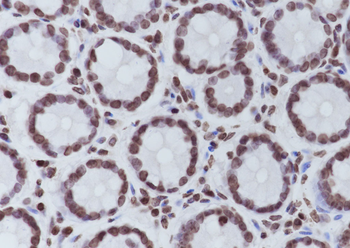 Di-Methyl-Histone H3 (Lys9) Mouse Monoclonal Antibody
