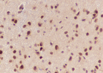 DBR1 Recombinant Mouse Monoclonal Antibody