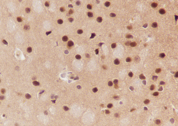 DBR1 Recombinant Mouse Monoclonal Antibody
