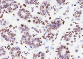 Malonyl-Histone H3 (Lys122) Recombinant Rabbit Monoclonal Antibody