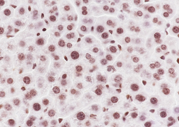 Malonyl-Histone H3 (Lys122) Recombinant Rabbit Monoclonal Antibody