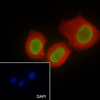Acetyl-Histone H4 (Lys16) Rabbit Polyclonal Antibody