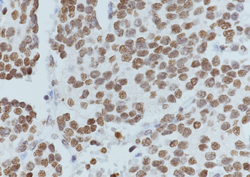 Acetyl-Histone H4 (Lys16) Rabbit Polyclonal Antibody