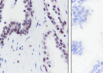 Propionyl-Histone H3 (Lys56) Recombinant Rabbit Monoclonal Antibody