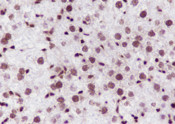 Ubiquityl-Histone H2B (Lys120) Recombinant Mouse Monoclonal Antibody