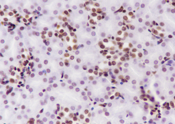 Ubiquityl-Histone H2B (Lys120) Recombinant Mouse Monoclonal Antibody