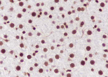 Ubiquityl-Histone H2B (Lys120) Recombinant Mouse Monoclonal Antibody