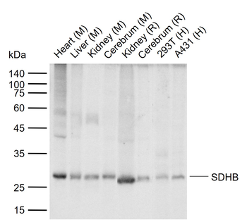 SDHB Recombinant Mouse Monoclonal Antibody