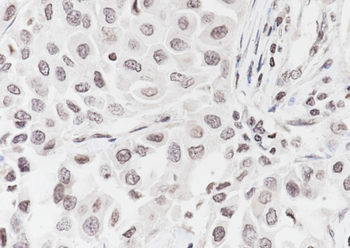 Mono-Methyl-Histone H3 (Lys79) Recombinant Rabbit Monoclonal Antibody