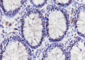 Mono-Methyl-Histone H3 (Lys79) Recombinant Rabbit Monoclonal Antibody