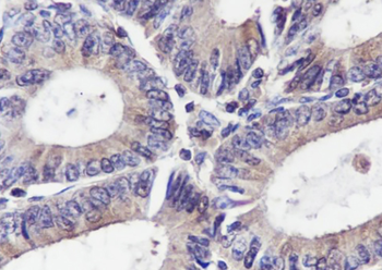 RAN Recombinant Mouse Monoclonal Antibody