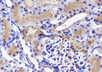 RAN Recombinant Mouse Monoclonal Antibody