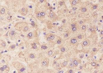 GCK Recombinant Mouse Monoclonal Antibody