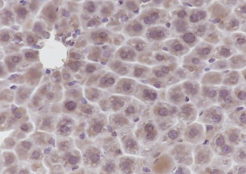 GCK Recombinant Mouse Monoclonal Antibody