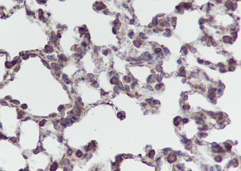 PTGER2 Recombinant Rabbit Monoclonal Antibody