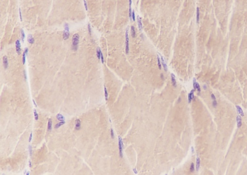 ATP5A1 Recombinant Mouse Monoclonal Antibody