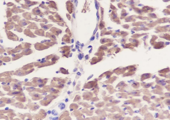 ATP5A1 Recombinant Mouse Monoclonal Antibody