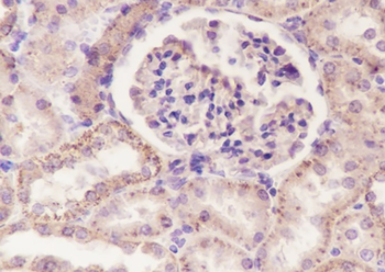 ATP5A1 Recombinant Mouse Monoclonal Antibody