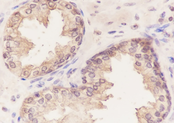 UGDH Recombinant Mouse Monoclonal Antibody