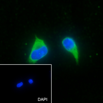BAP31 Recombinant Rabbit Monoclonal Antibody
