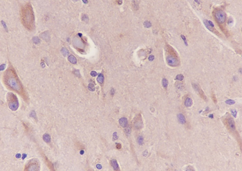 BAP31 Recombinant Rabbit Monoclonal Antibody