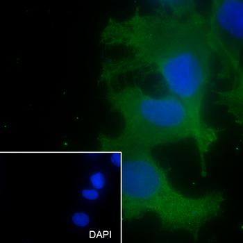 GNB3 Recombinant Mouse Monoclonal Antibody