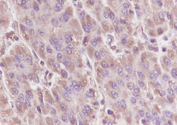GNB3 Recombinant Mouse Monoclonal Antibody