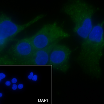 GNA13 Recombinant Mouse Monoclonal Antibody