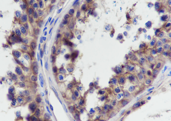 GNA13 Recombinant Mouse Monoclonal Antibody